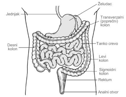 colon cancer